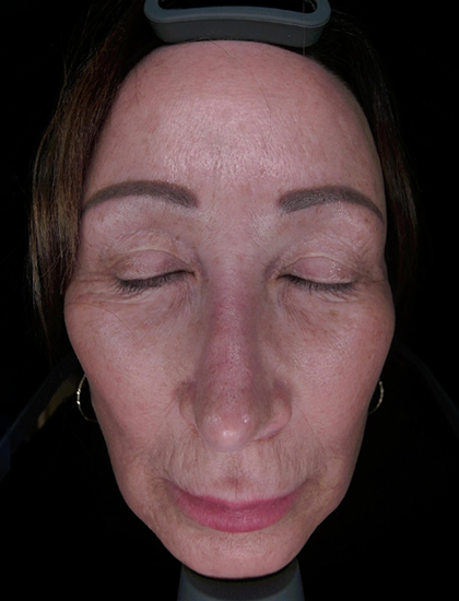 White Light (Standard Clinical View)