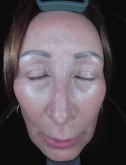 Positive Polarised Light (Surface & Texture Analysis)