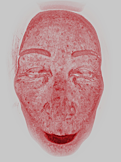 Red Light (Vascular Emphasis)