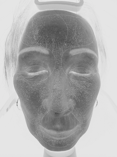 White Map (Texture & Collagen Analysis) 